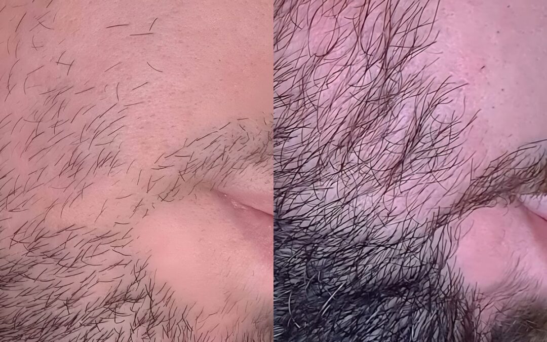 La “barbe à bidou” : décryptage d’un style populaire