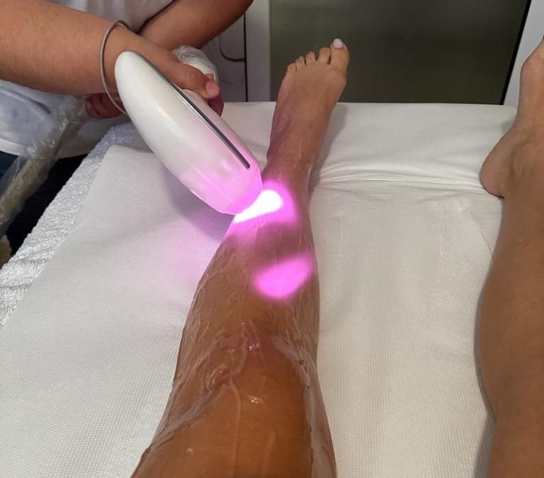 Épilation définitive au laser : guide et conseils pour faire le bon choix